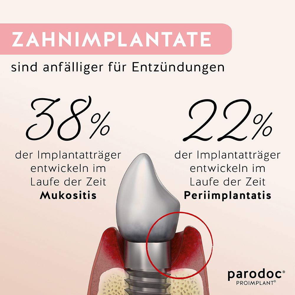 Modèle d'implant dentaire. Texte: 38% mucosite, 22% péri-implantite. Logo parodoc® PROIMPLANT®.