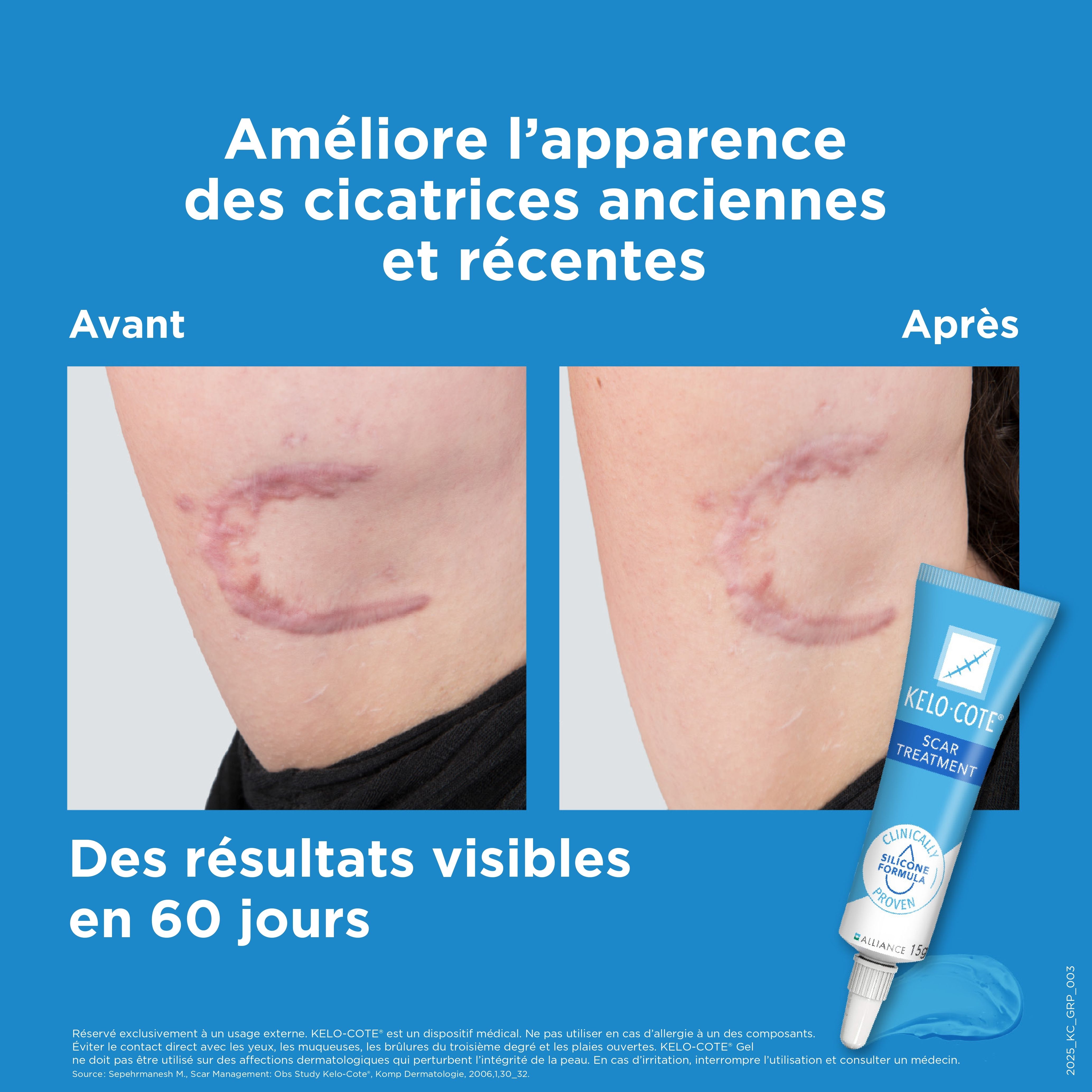 Kelo-Cote Silicone Gel