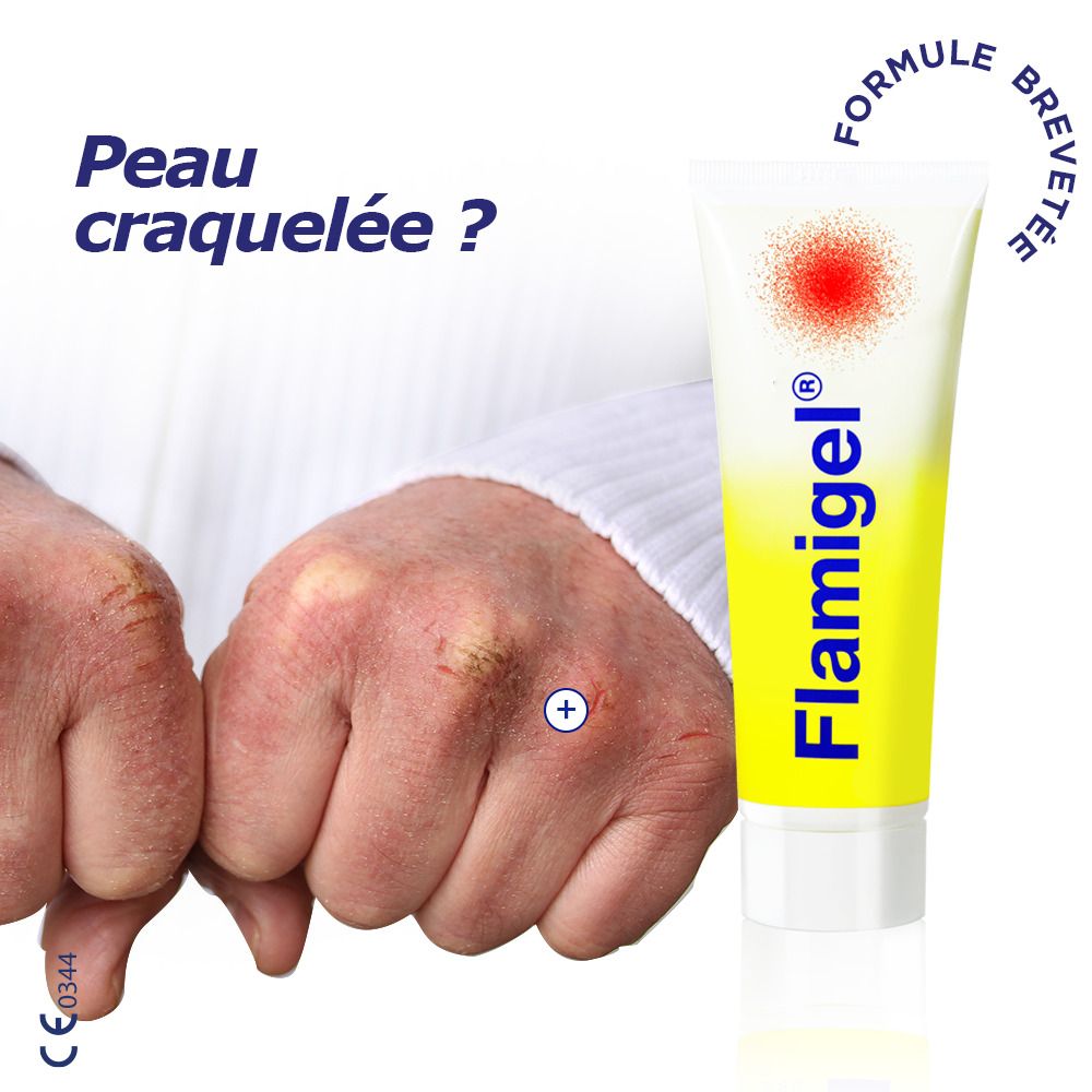 Tube de gel Flamigel®. Tube avec fond jaune et point rouge. Question: Peau craquelée ?