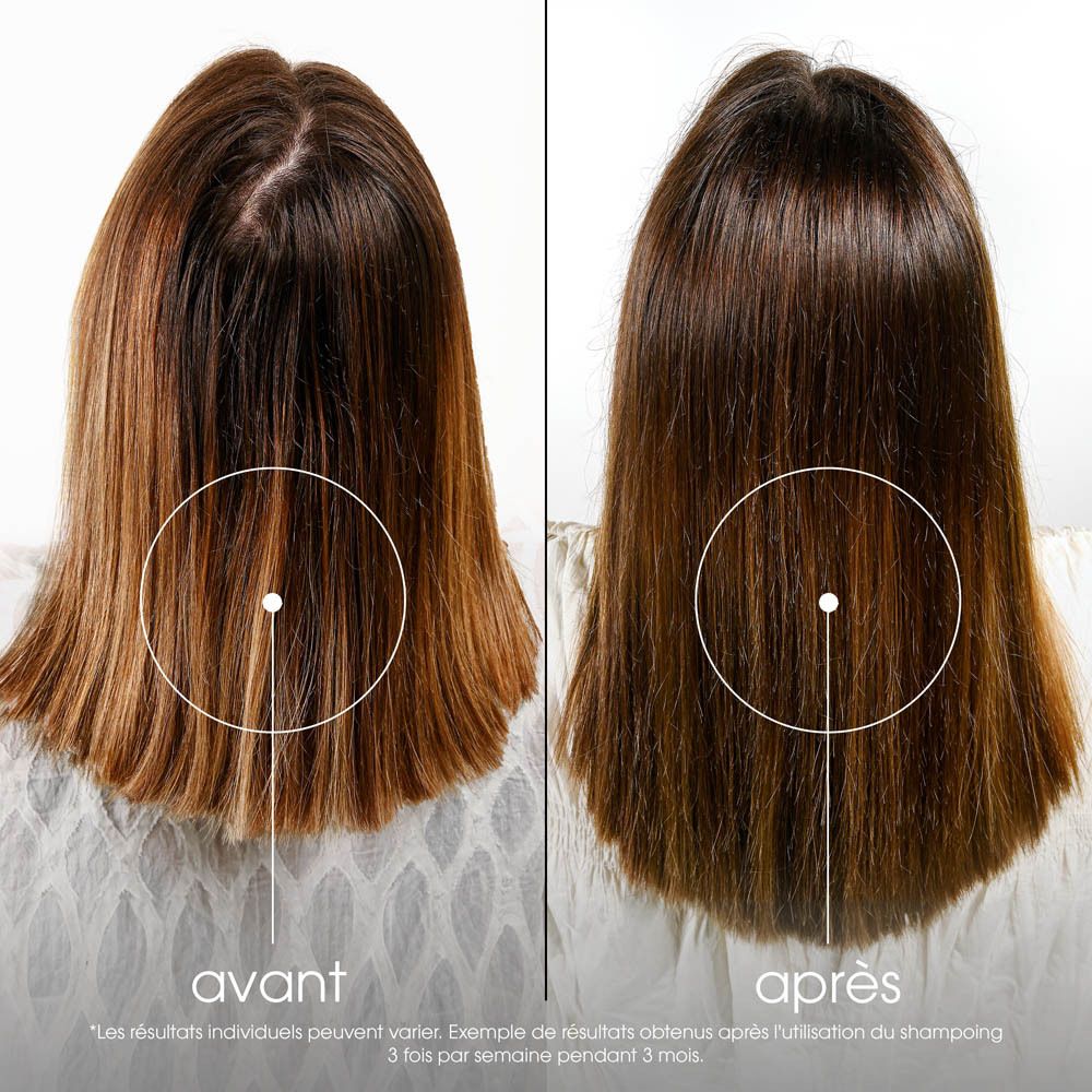 Image avant-après de femmes avec perte de cheveux. Texte: avant, après.