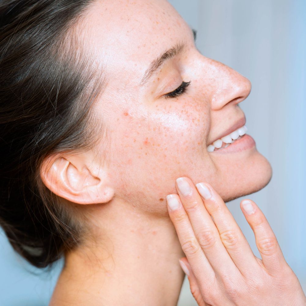 SVR SEBIACLEAR Micro-Peel