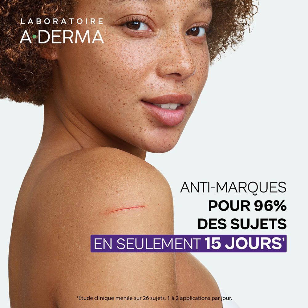 Femme avec cicatrices sur l'épaule. Texte: Anti-marques, 96% des sujets en 15 jours.