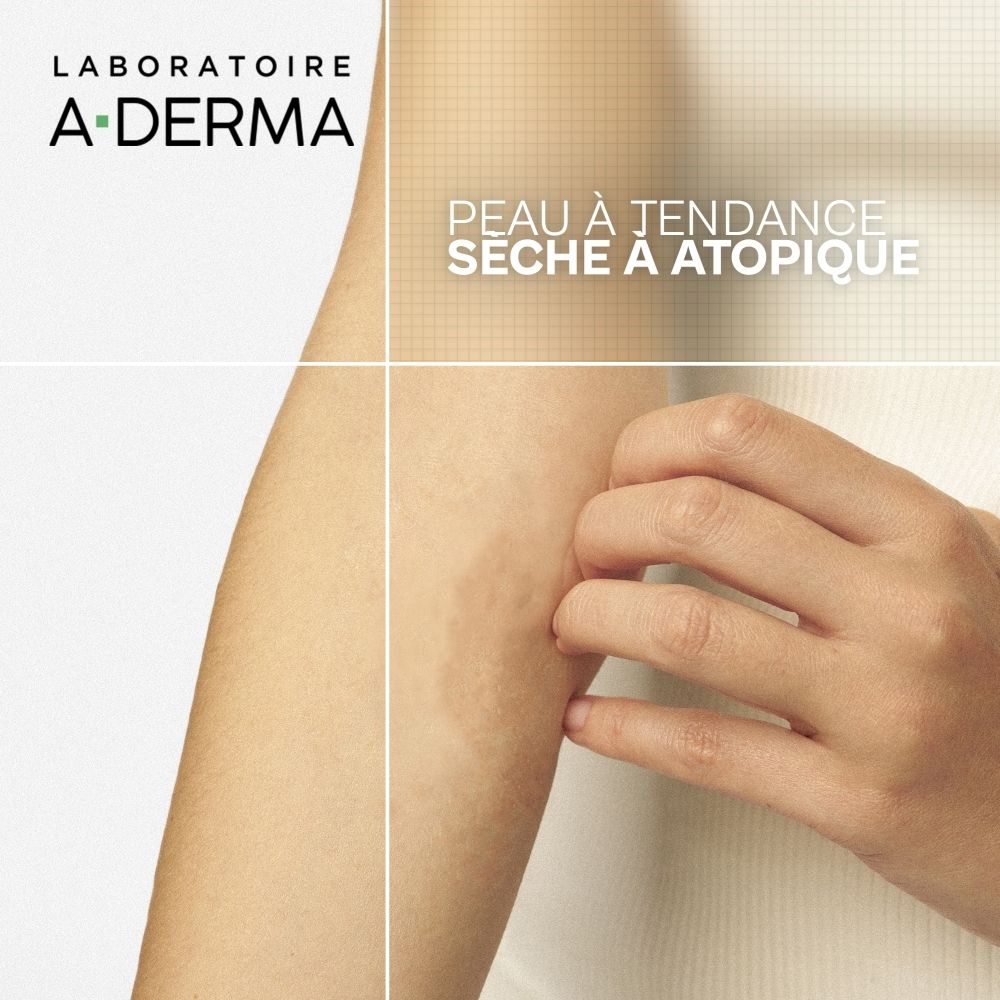 Laboratoire A-Derma: Für trockene, atopische Haut. Schlaf ist 2x erholsamer. Reduziert Juckreiz um 95%.