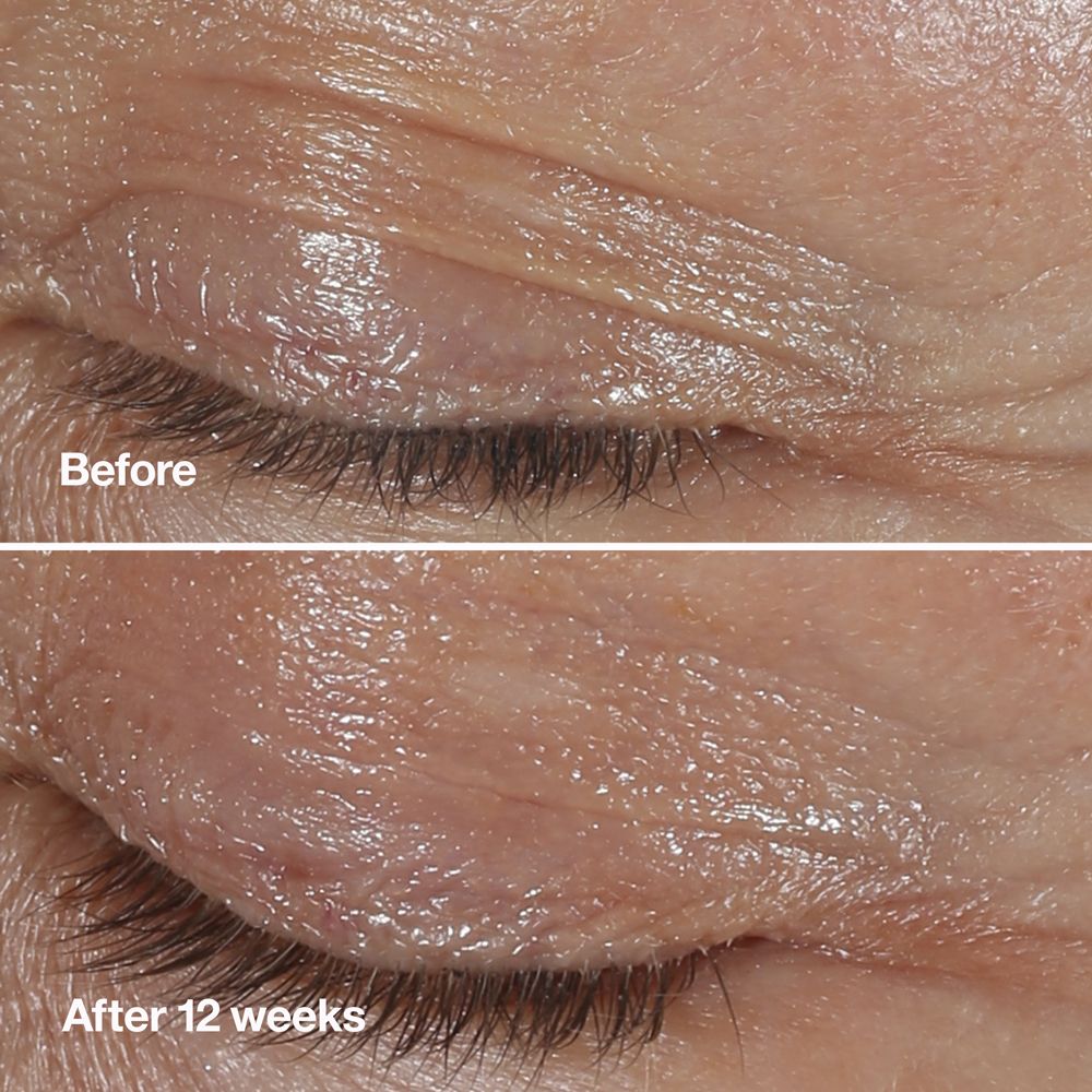 Clinique Smart Clinical Repair™ Crème Yeux Correction Rides - Soin des Yeux Anti-Âge