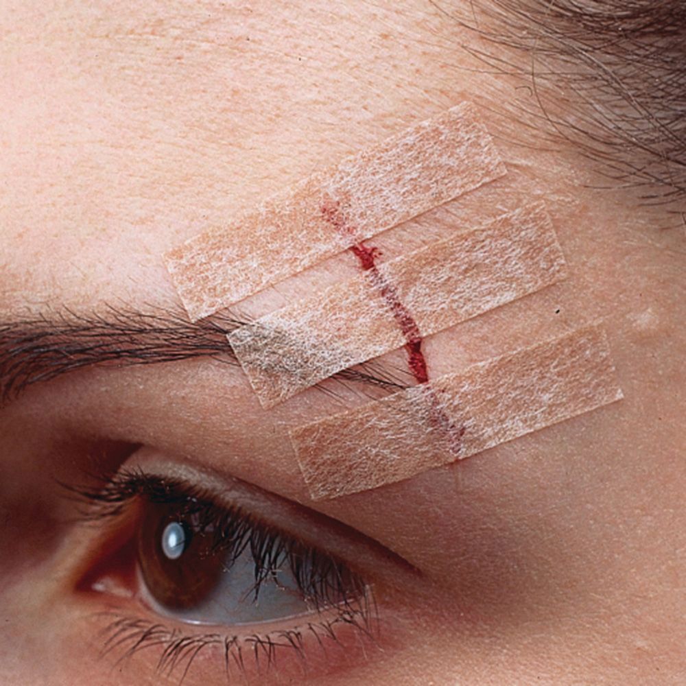 Nexcare™ Steri-Strip™ Hautnahtmaterial Hautfarbe 6 mm x 75 mm