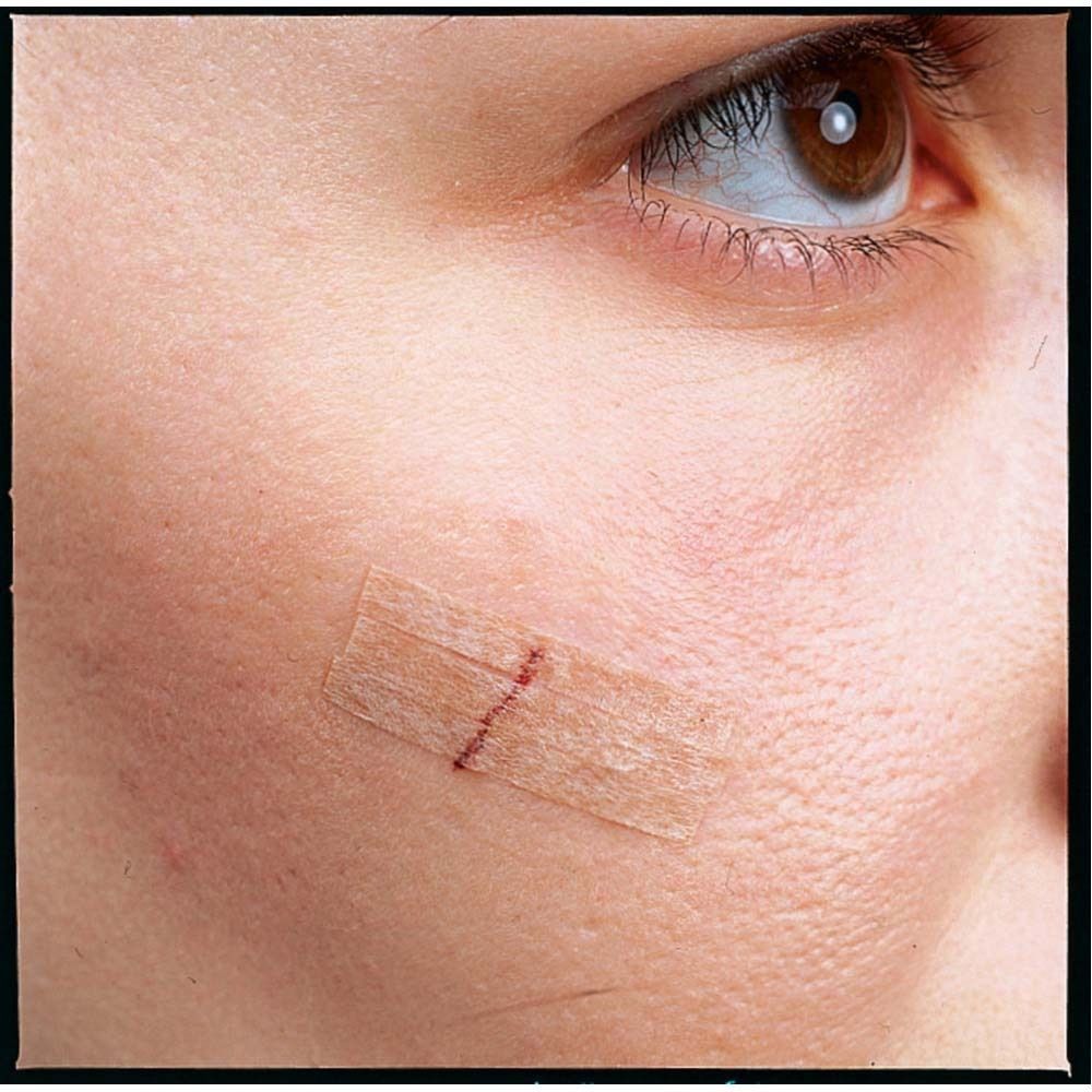 Verpackung mit Nexcare Steri-Strip Hautnahtmaterial. Enthält 6 Streifen. Größe: 6 mm x 75 mm. Hautfarben.