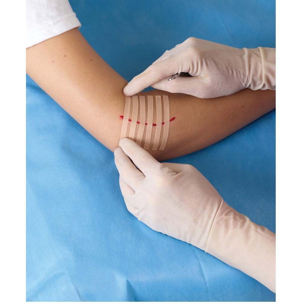 Verpackung mit Nexcare Steri-Strip Hautnahtmaterial. Enthält 6 Streifen. Größe: 6 mm x 75 mm. Hautfarben.