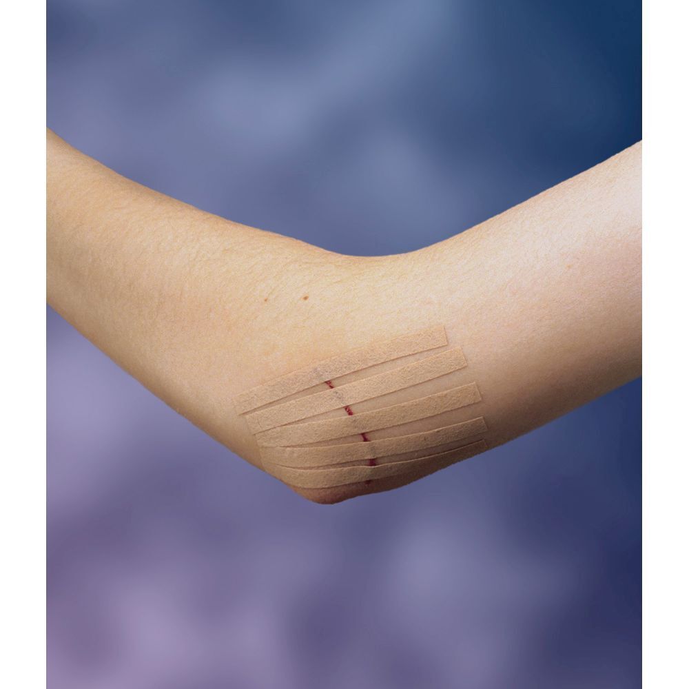 Nexcare™ Steri-Strip™ Hautnahtmaterial Hautfarbe 6 mm x 75 mm