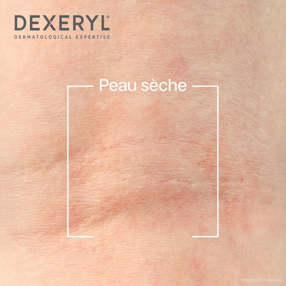 Gros plan sur peau sèche avec texte. Dispositif médical.