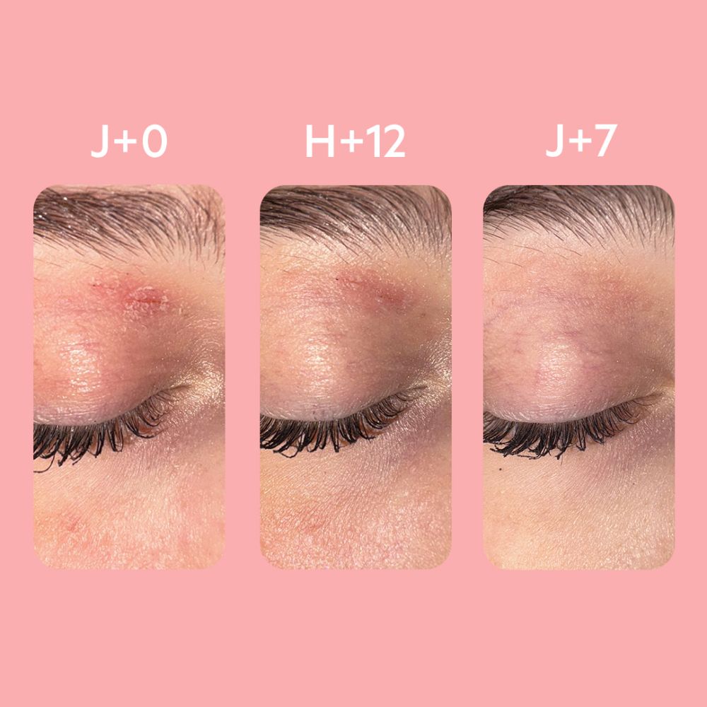 SVR Palpebral Baume 30ml
