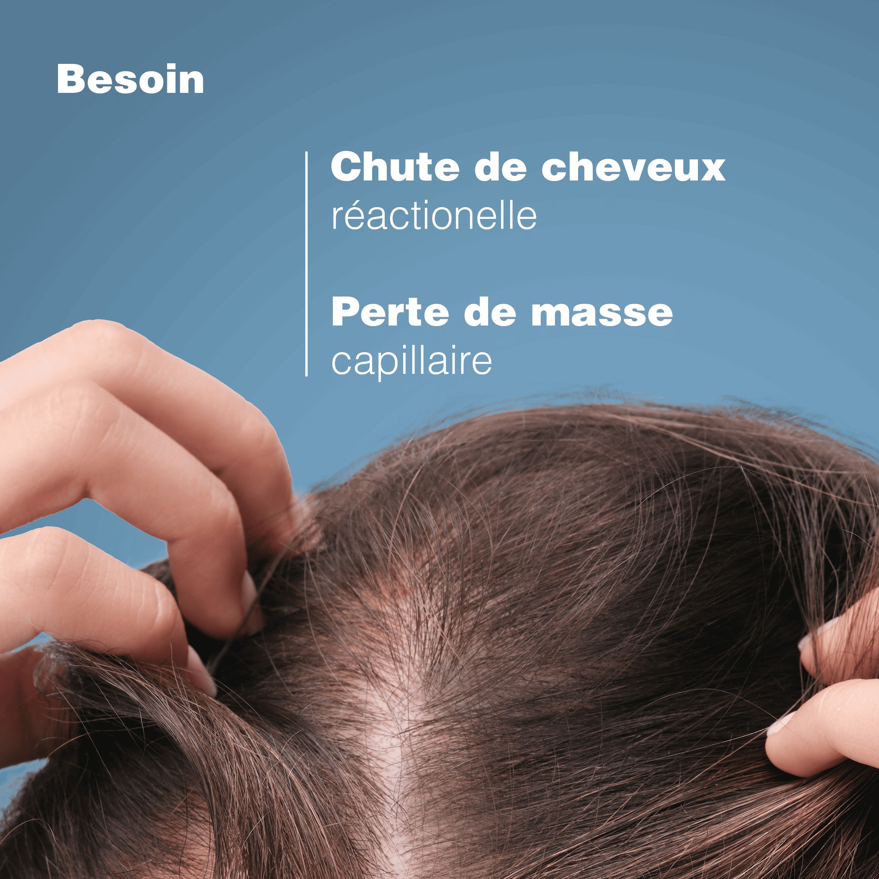 Gros plan sur cheveux et cuir chevelu. Texte: besoin, chute de cheveux réactionnelle, perte de masse.