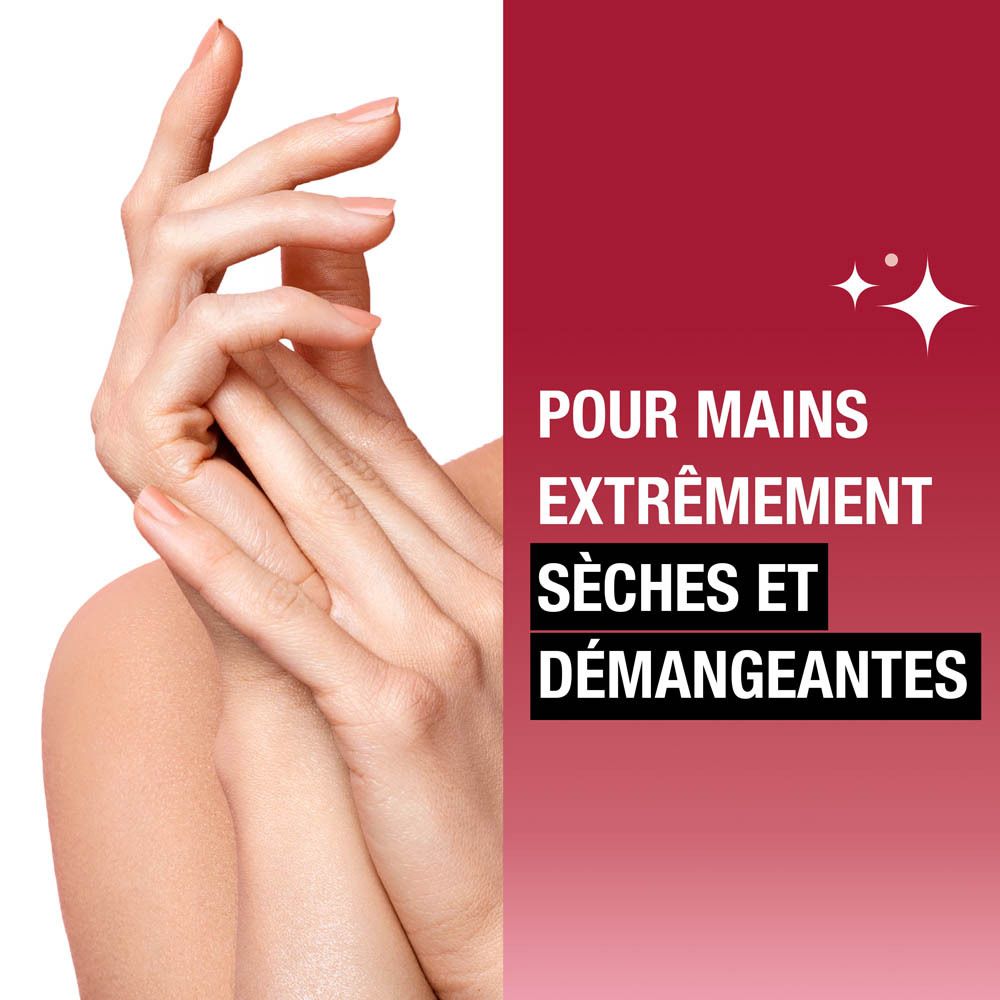 Mains avec peau sèche et qui démange. Texte: Pour mains extrêmement sèches et démangeantes.