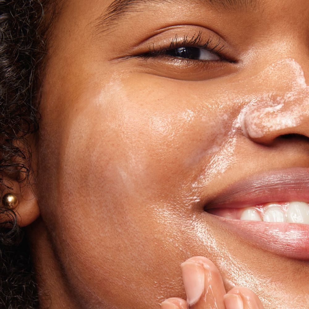 Gros plan d'un visage avec produit nettoyant. La peau brille. Le produit est blanc.
