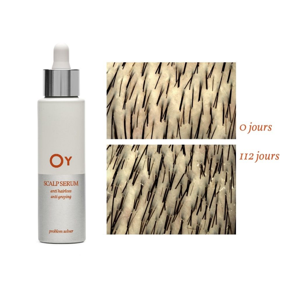 Arrière d'un flacon de Sérum Oy pour cuir chevelu, avec instructions d'utilisation et ingrédients.