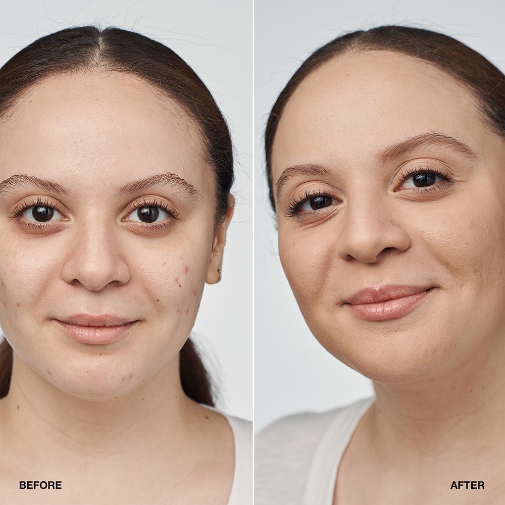 Comparaison avant/après d'une femme portant le fond de teint sérum Clinique Even Better Clinical SPF 20.