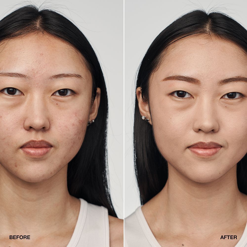 Comparaison avant/après d'une femme portant le fond de teint sérum CLINIQUE Even Better Clinical SPF 20.
