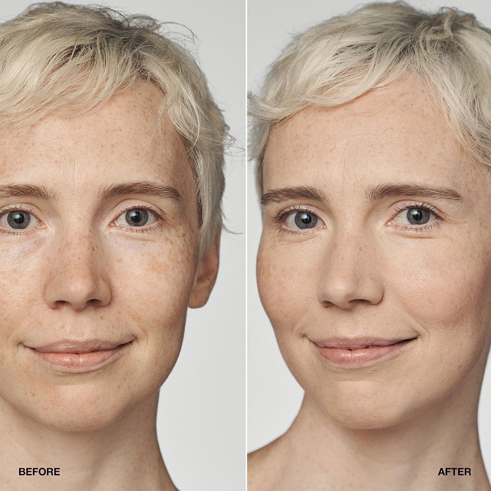 Comparaison avant/après d'une femme avec le fond de teint sérum CLINIQUE Even Better Clinical SPF 20.