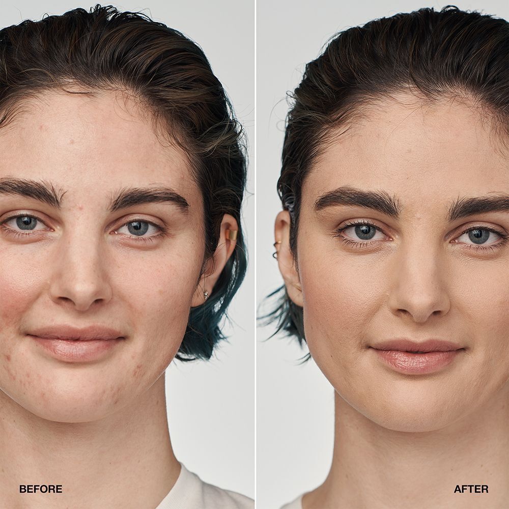 Comparaison avant-après d'une femme portant le fond de teint sérum CLINIQUE Even Better Clinical.