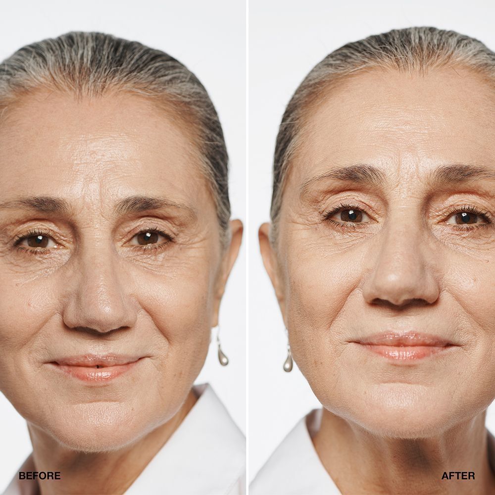 Vorher-Nachher-Vergleich einer Frau, die CLINIQUE Even Better Makeup SPF 15 verwendet.