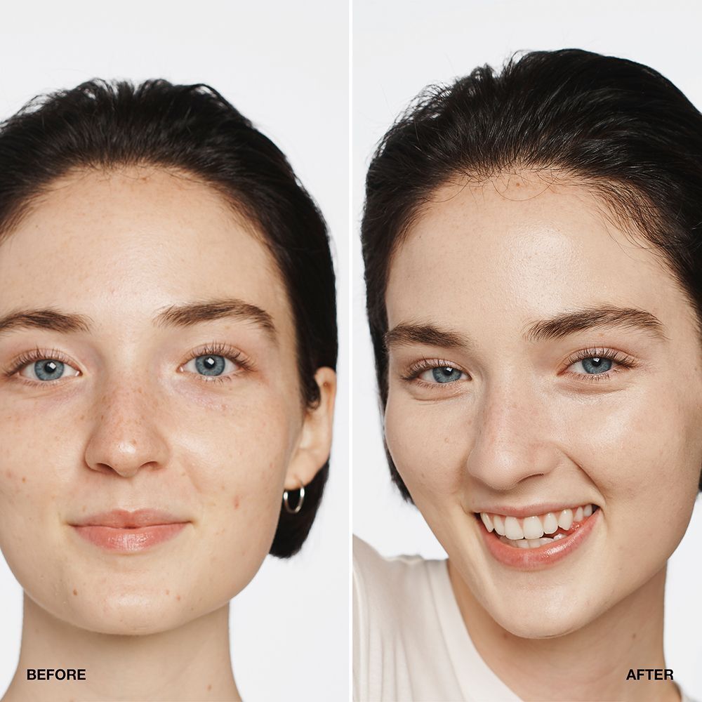 Vorher-Nachher-Vergleich einer Frau, die Clinique Even Better Makeup SPF 15 verwendet.