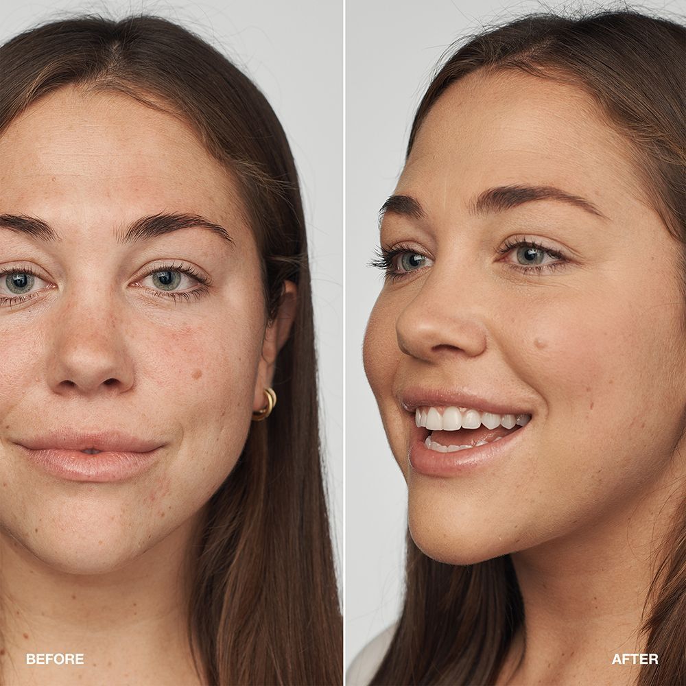 Comparaison avant/après d'une femme utilisant le fond de teint sérum Clinique Even Better Clinical.