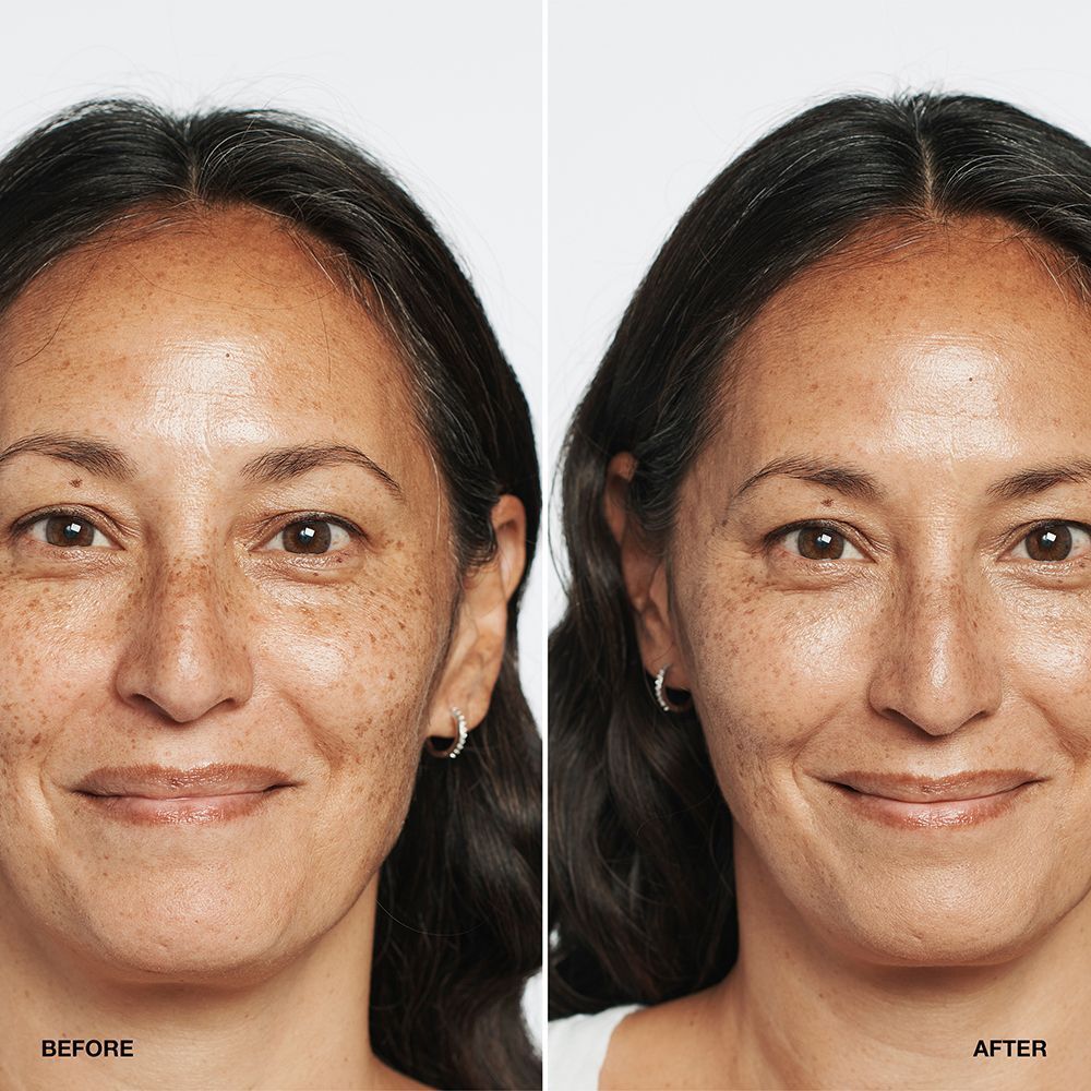 Vorher-Nachher-Vergleich einer Frau mit CLINIQUE Even Better Makeup SPF 15.