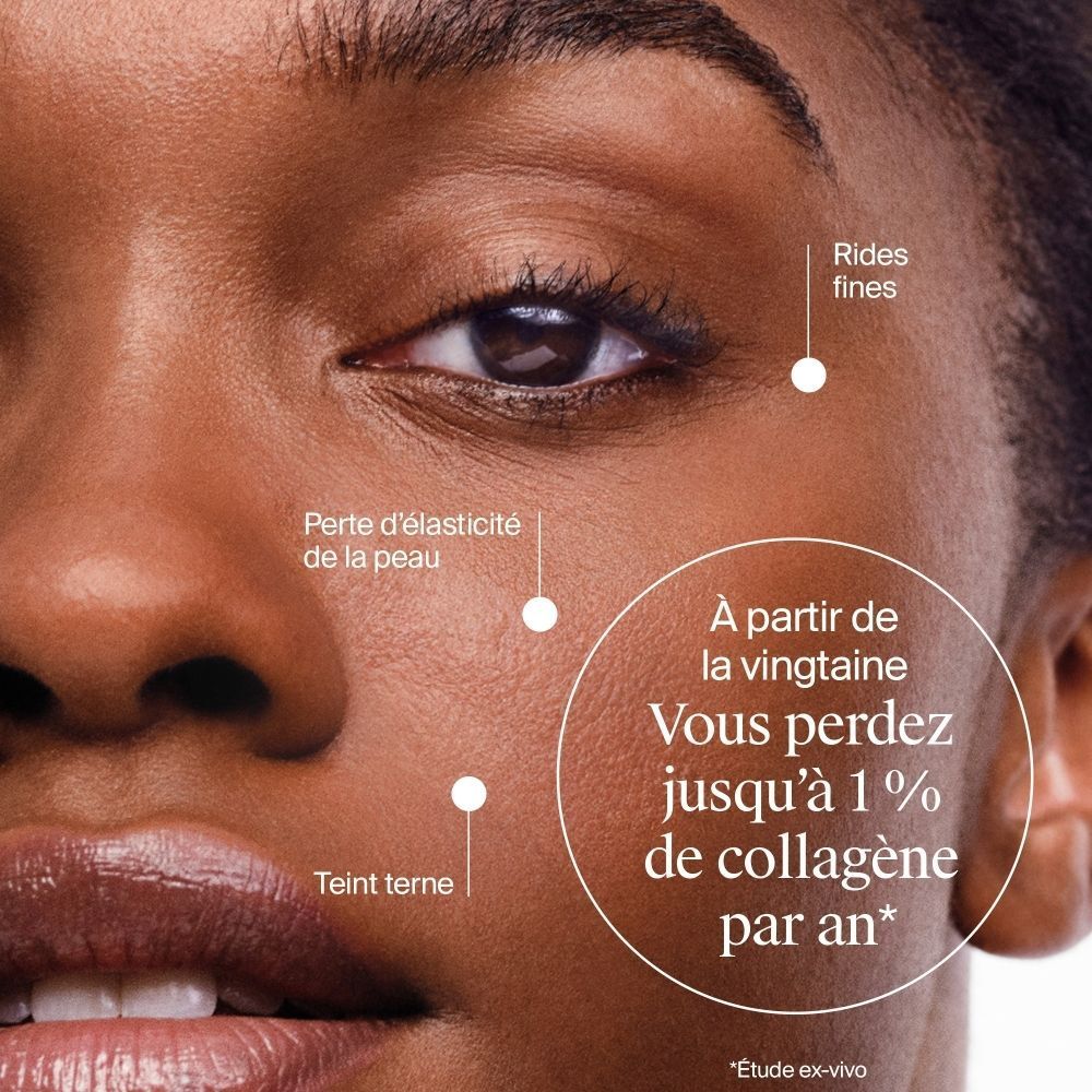 Gros plan d'un visage montrant les effets de la perte de collagène.