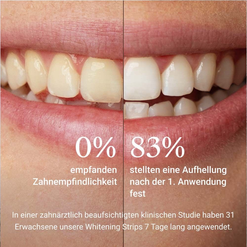ALPINE WHITE Whitening Strips - Bandes de blanchiment des dents