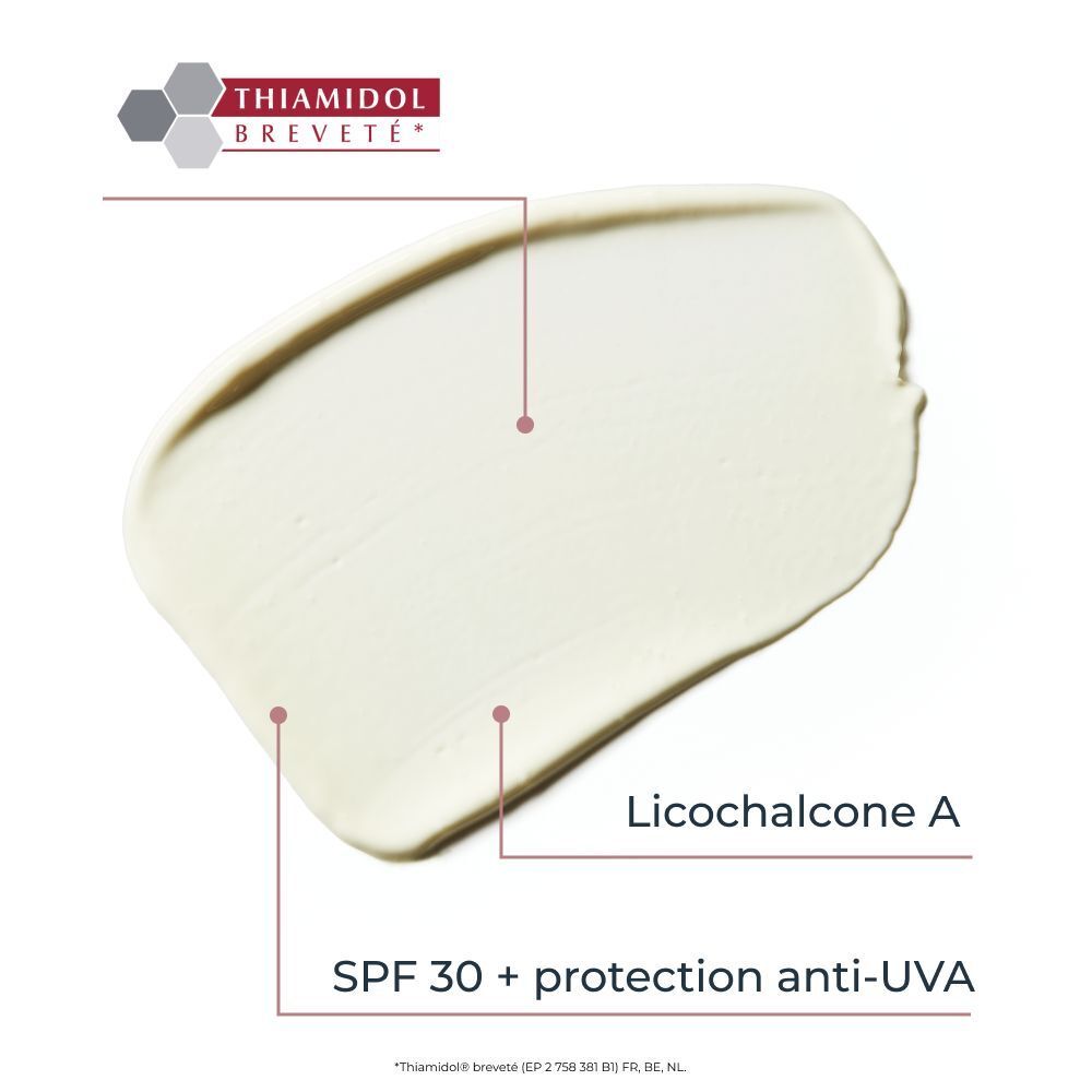 Images avant-après de pigmentation cutanée traitée avec Eucerin Anti-Pigment.