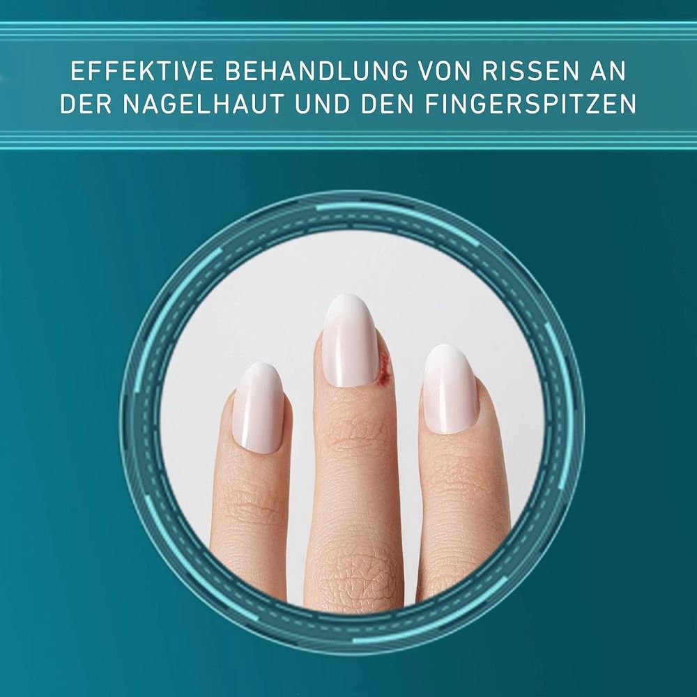 Nahaufnahme von Fingern mit Rissen an der Nagelhaut. Text: Effektive Behandlung von Rissen an der Nagelhaut.