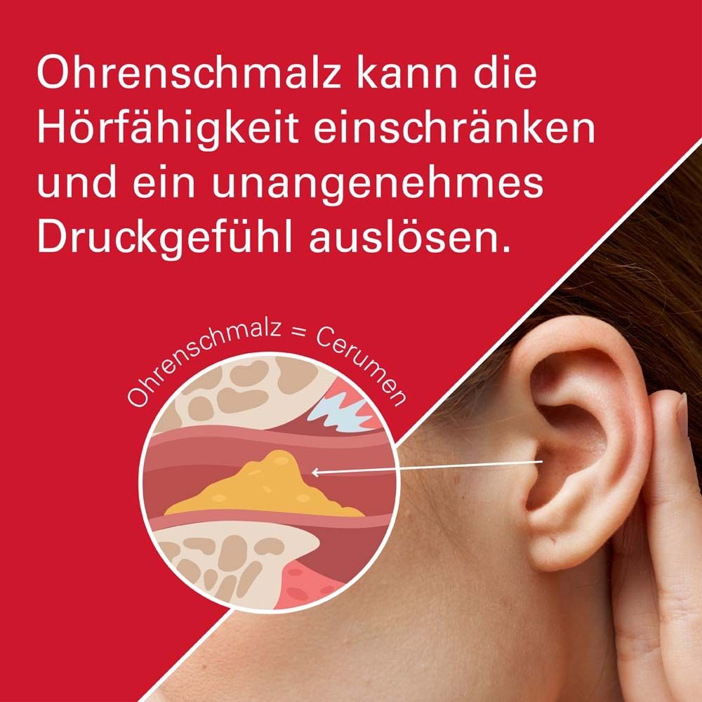 Illustration graphique d'une oreille avec du cérumen. Illustration médicale pour visualiser le cérumen.