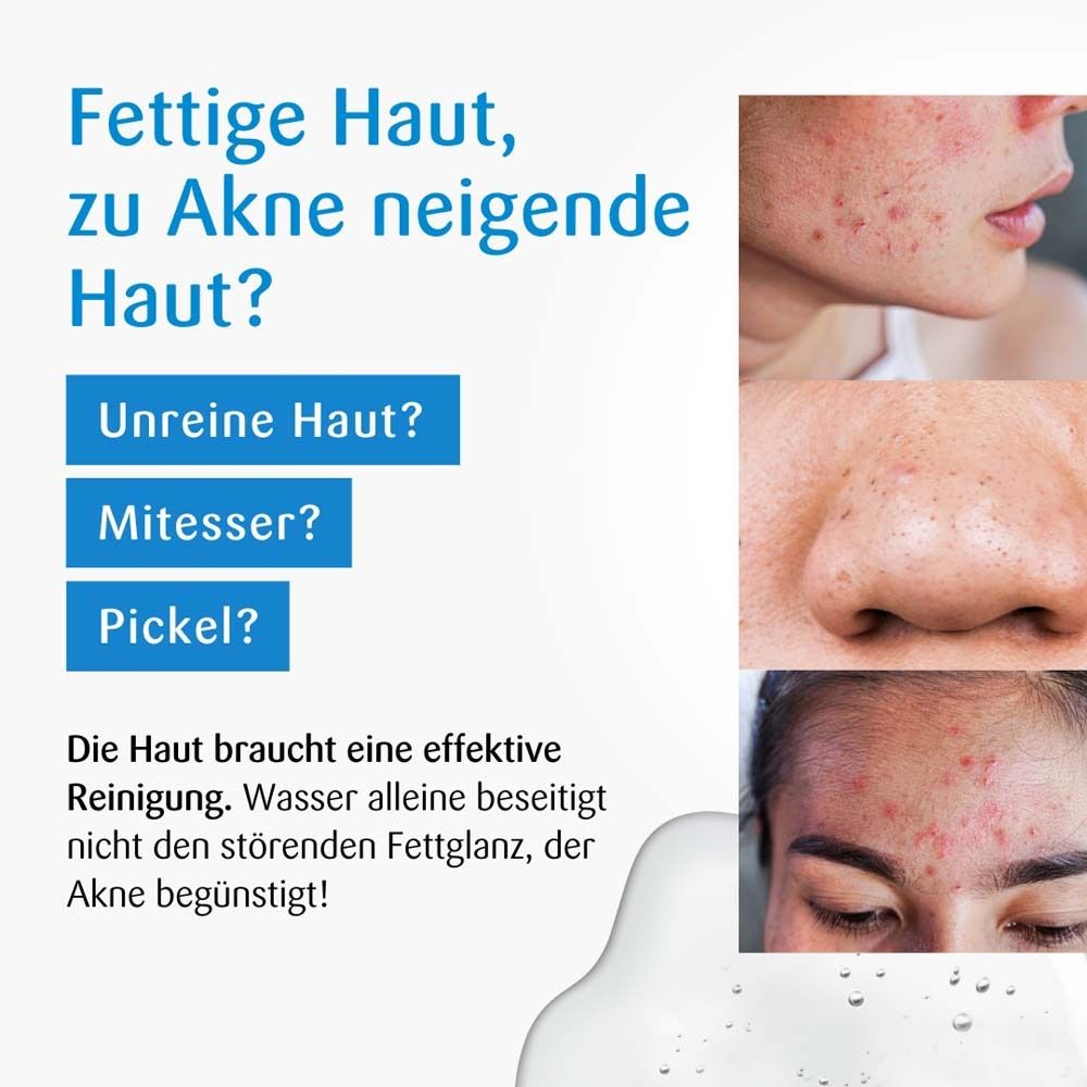 Image publicitaire avec benevi hydroderm Gesichts-Reinigung. Texte: Peau grasse, sujette à l'acné ? Images d'imperfections cutanées.