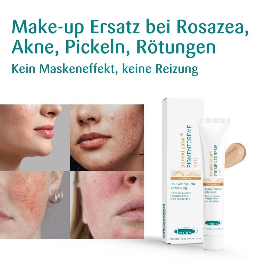 Gesichtsbilder mit Hautunreinheiten. Daneben Tube und Verpackung von benevi color Pigmentcreme hell.