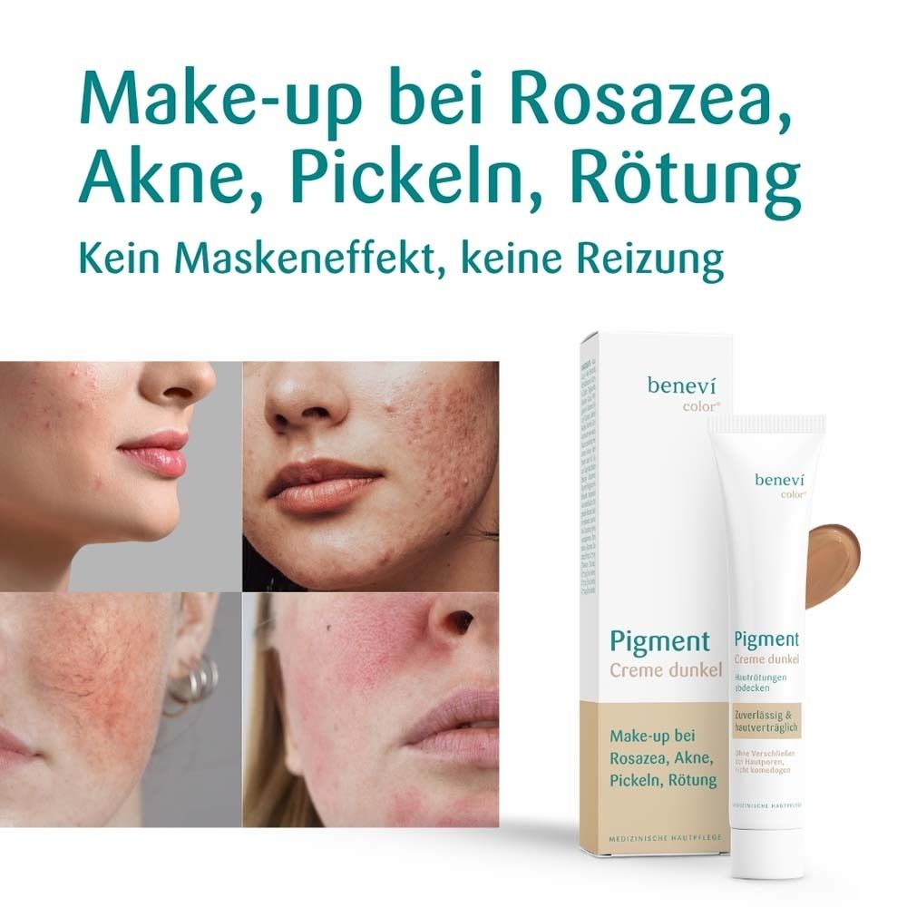 Gesichtsbilder mit Hautunreinheiten. BENEVI COLOR® Pigmentcreme dunkel und Verpackung.