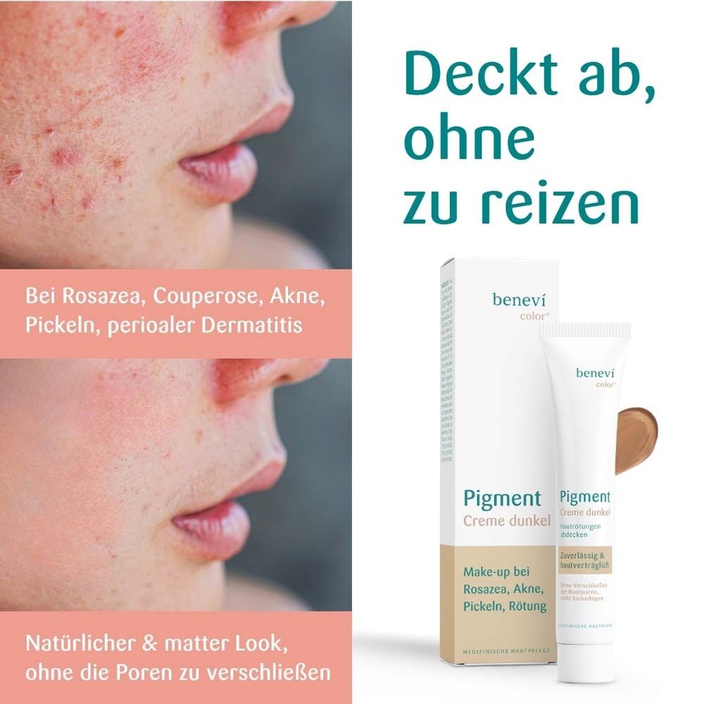 Gesichtsbilder mit Hautunreinheiten. BENEVI COLOR® Pigmentcreme dunkel und Verpackung.