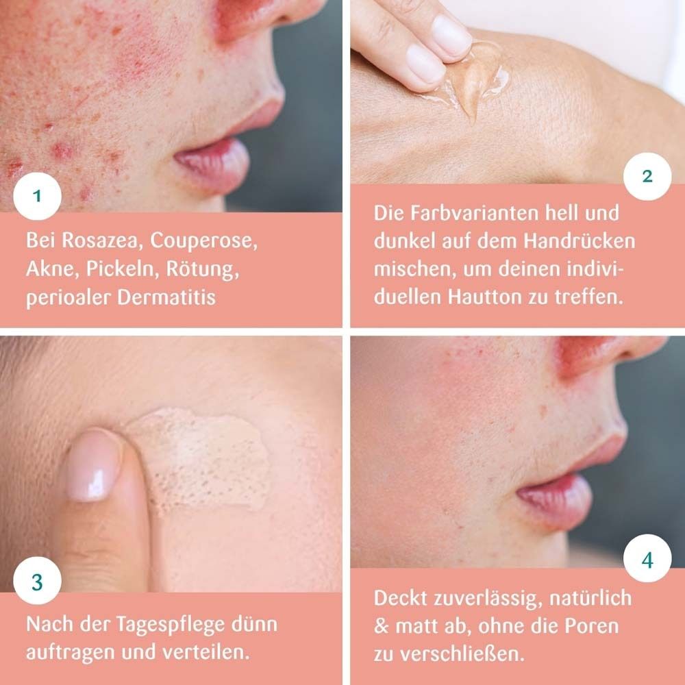 Anwendungsschritte von BENEVI COLOR® Pigmentcreme dunkel. Produkt und Verpackung.