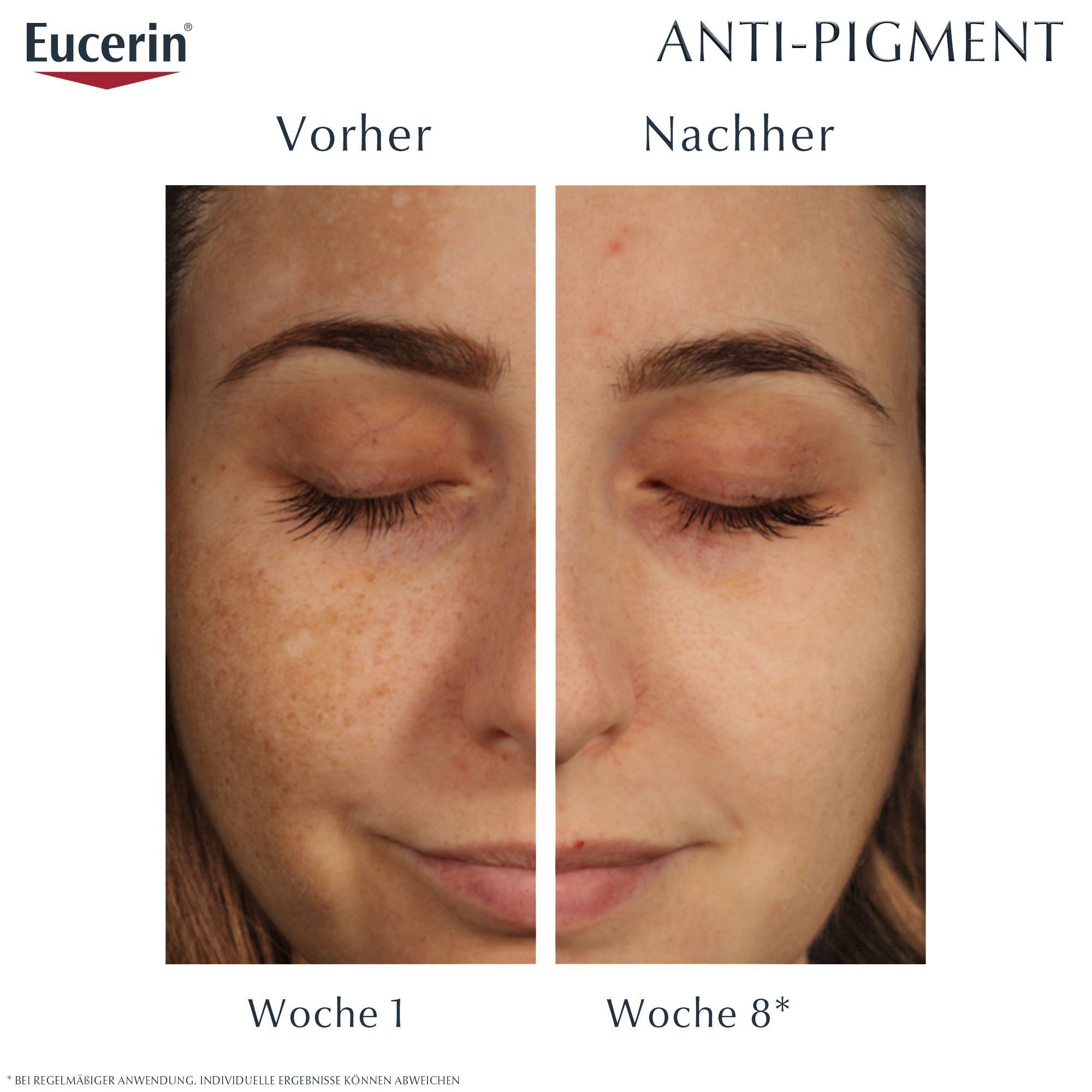 Eucerin® Anti-Pigment Tag & Nacht Set