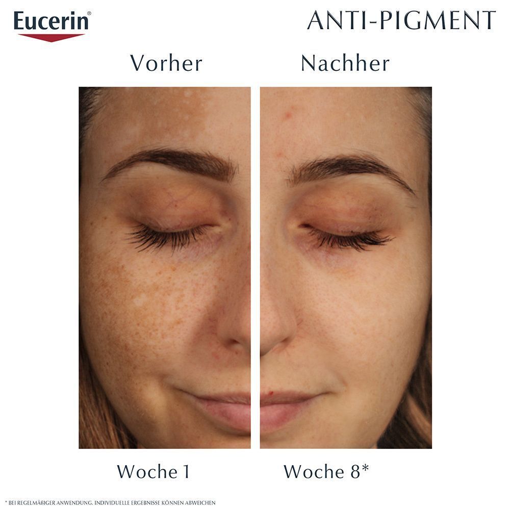 Comparaison avant-après : peau avec taches pigmentaires, puis nettement améliorée après 8 semaines. Eucerin.