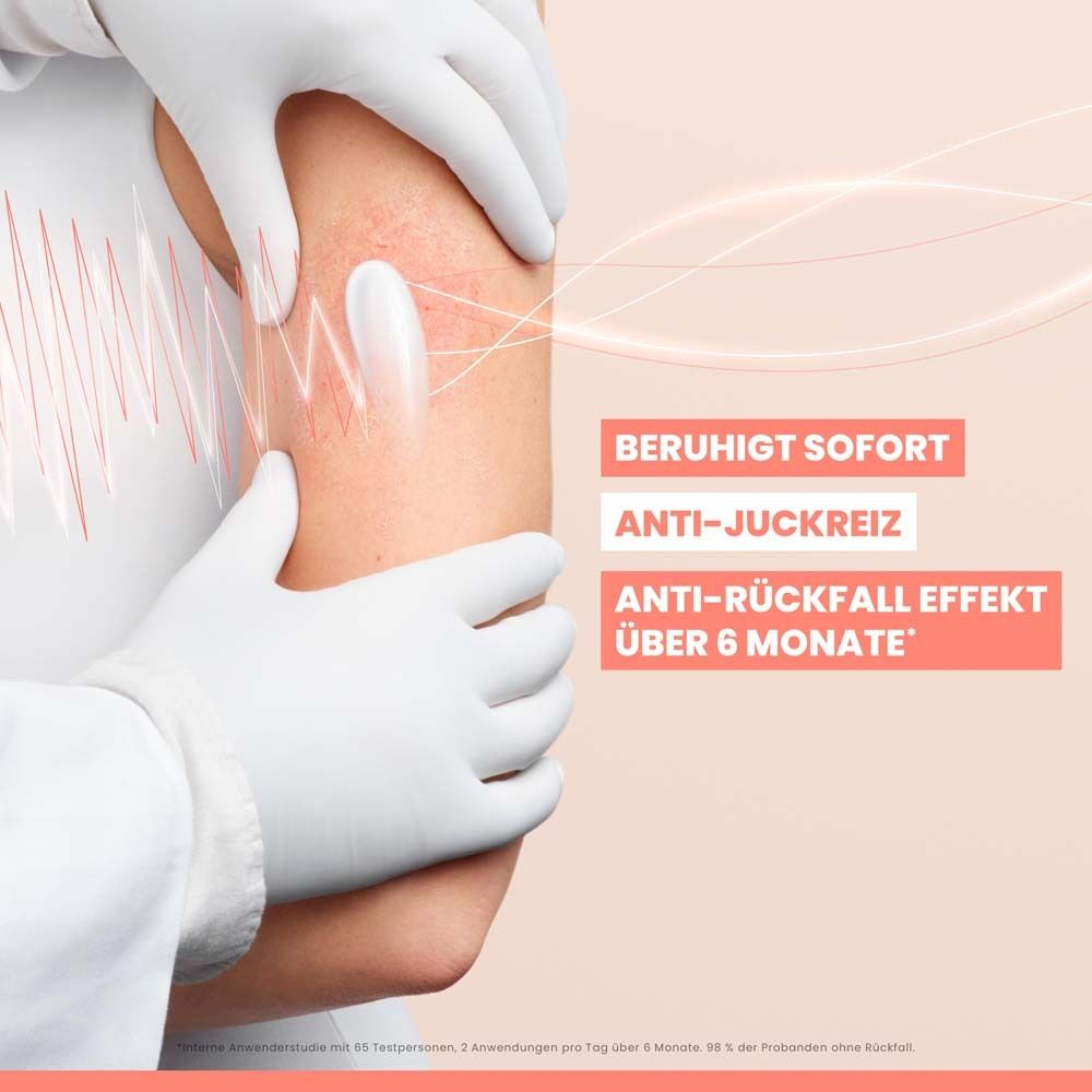 Arm mit Hautausschlag, der mit einer Creme behandelt wird. Text: Beruhigt sofort, Anti-Juckreiz, Anti-Rückfall-Effekt.