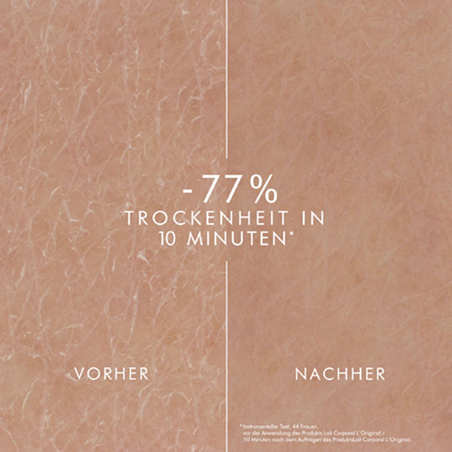 Haut vor und nach der Anwendung. Text: -77% Trockenheit in 10 Minuten. Vorher: trockene Haut. Nachher: glatte Haut.