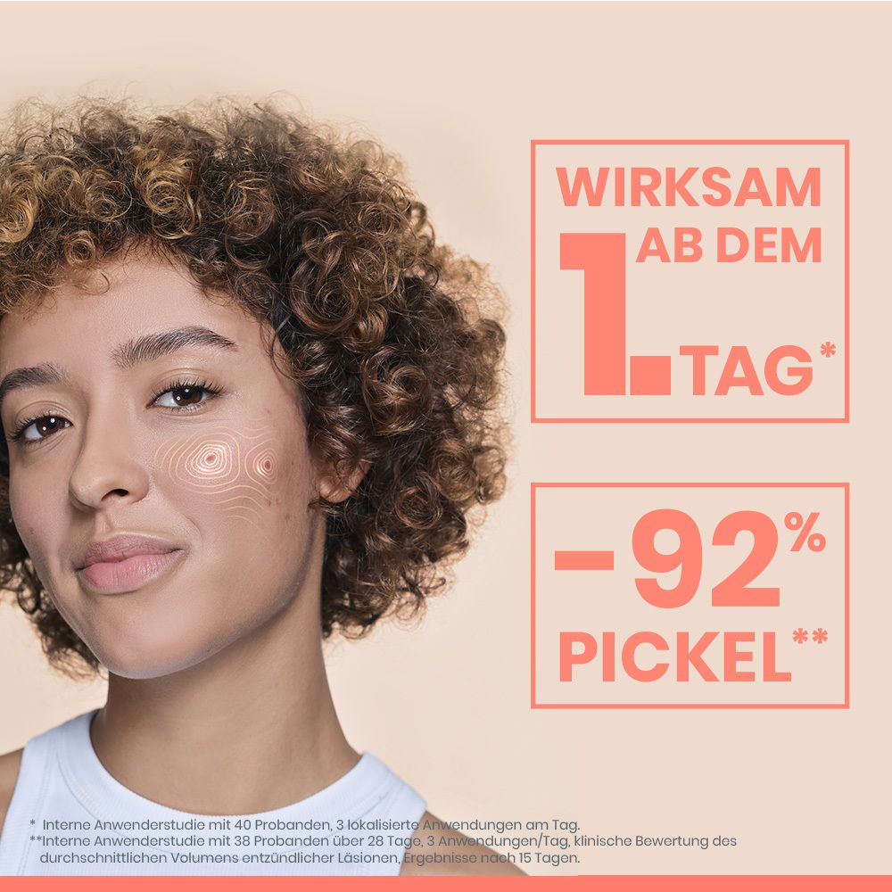 Frau mit lockigem Haar und Hauttextur-Overlay auf der Wange. Text: Wirksam ab dem 1. Tag, -92% Pickel.