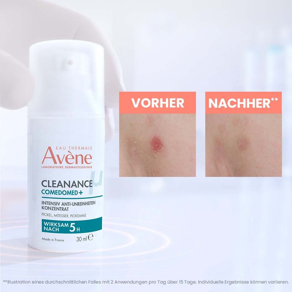 Avène Cleanance Gel Nettoyant dans un flacon turquoise avec pompe. Texte : Visage et corps.