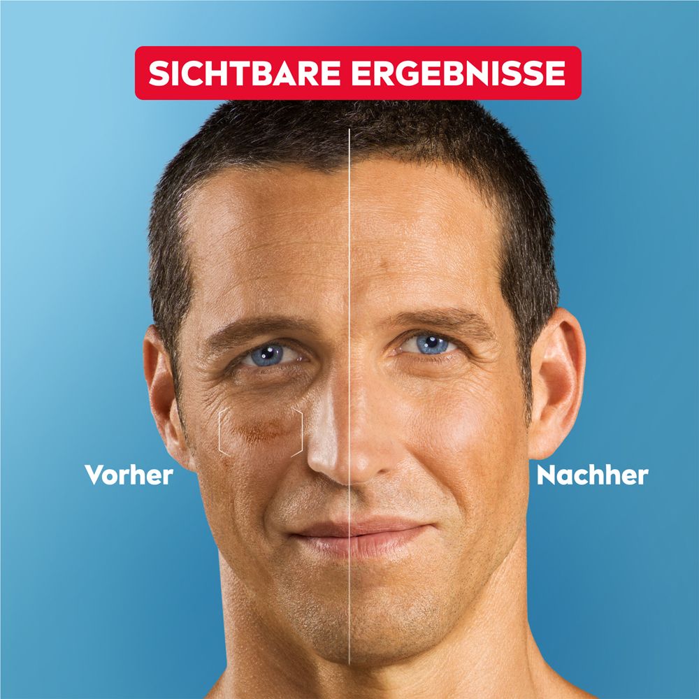 Comparaison avant-après : homme avec taches pigmentaires et rides, après utilisation de la crème.