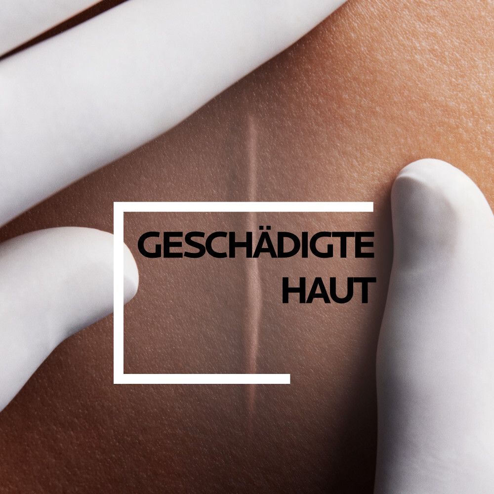 Peau endommagée. Gros plan sur une zone de peau avec une cicatrice.