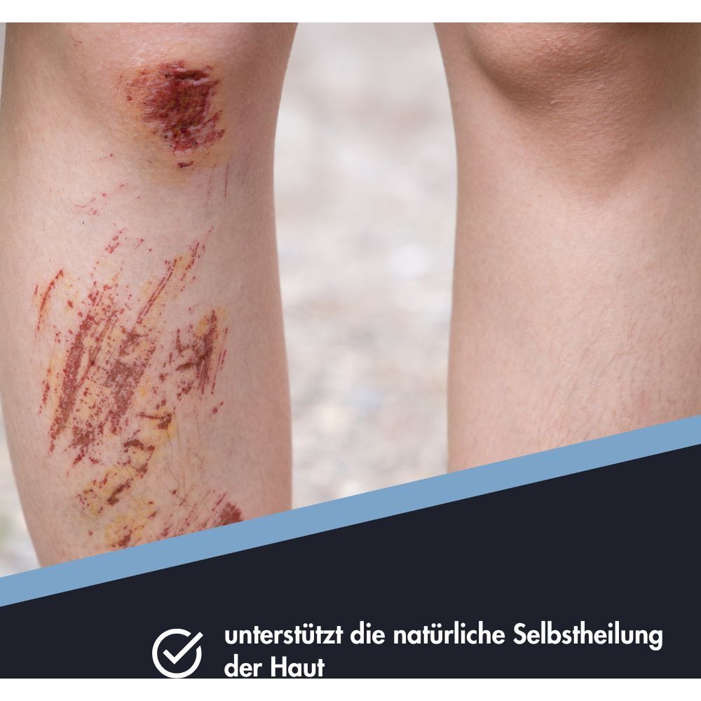 Vergleich von Haut: links eine stark aufgeschürfte, blutige Wunde am Knie, rechts gesunde Haut.