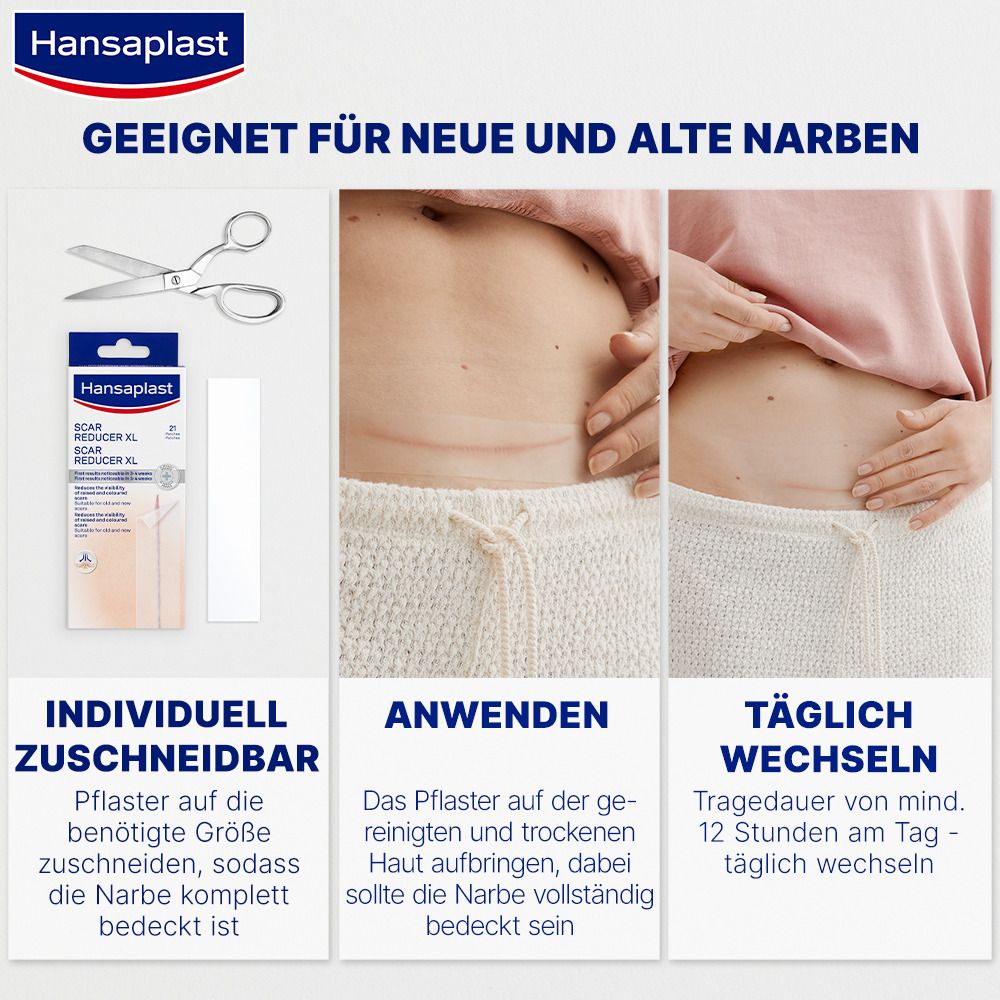 Hansaplast Narben Reduktion XL
