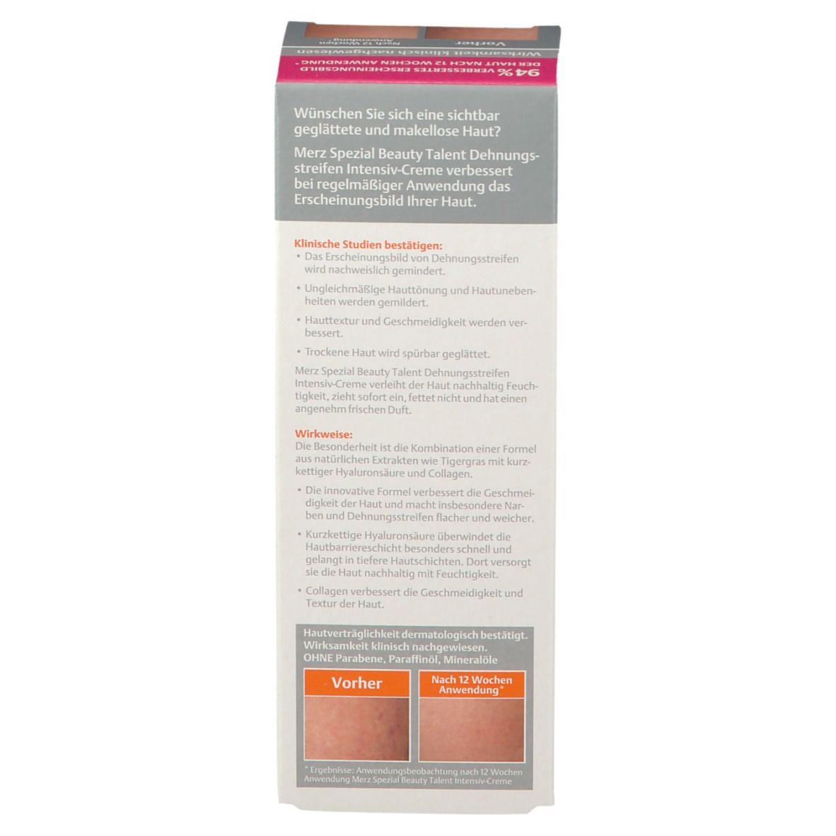 MERZ SPECIAL STRETCH MARK INTENSIVE CREAM