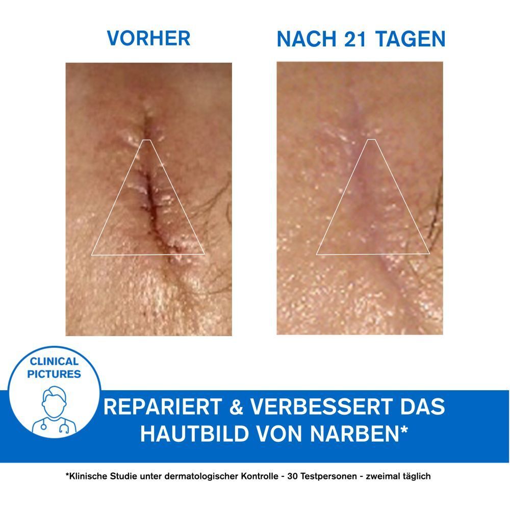 URIAGE Bariéderm Cica-Crème au Cuivre-Zinc