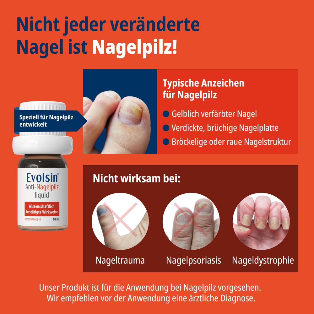 Typische Anzeichen von Nagelpilz und was nicht damit verwechselt werden sollte, mit Produktabbildung.