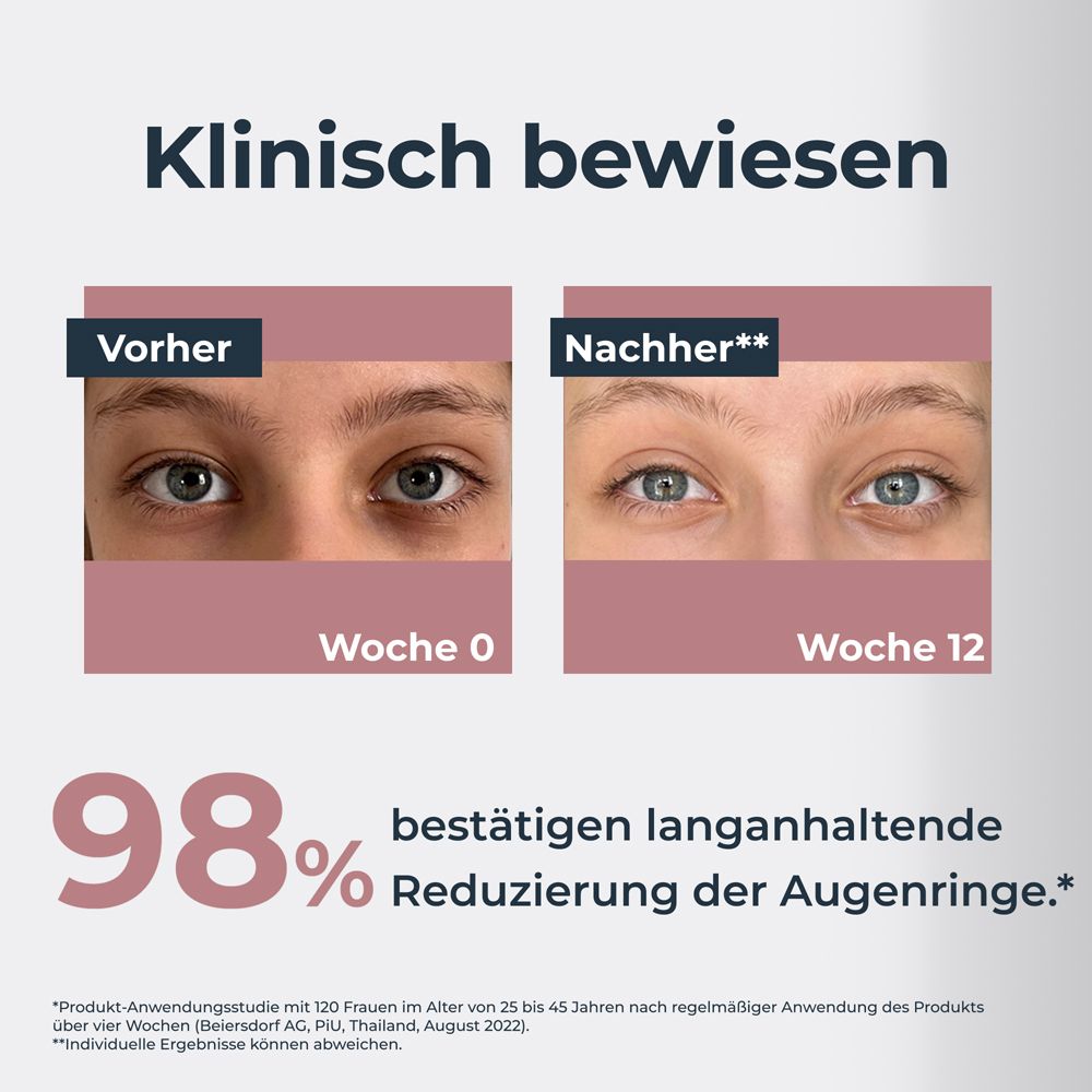 Vorher-Nachher-Vergleich von Augenringen nach 12 Wochen Behandlung.